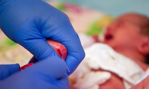 A sample of blood being taken from a baby