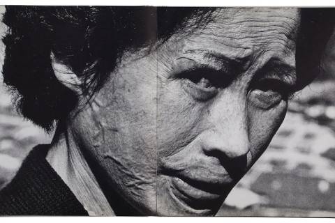 Tōmatsu Shōmei, Hibakusha Kataoka Tsuyo, Nagasaki, 1961